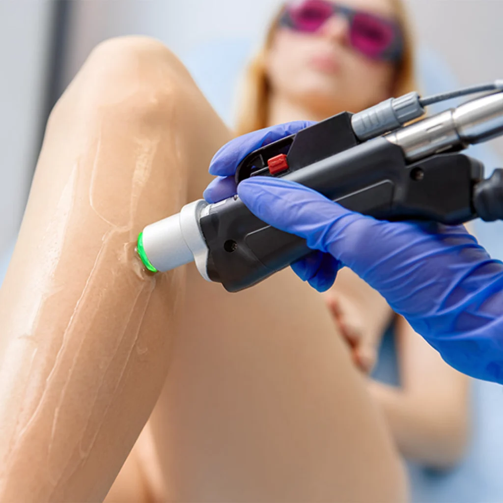 DEKA Motus AX Alexandrit Laser Haarentfernung Damen Köln